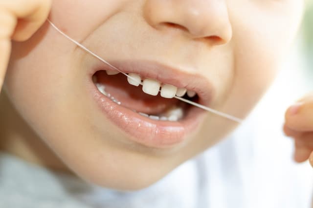 Apakah Pemakaian Benang Gigi (Flossing) Bermanfaat bagi Anak?