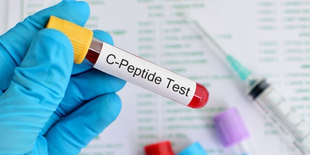 Peran C-Peptide dalam Diagnostic Workup Pasien Diabetes pada Anak