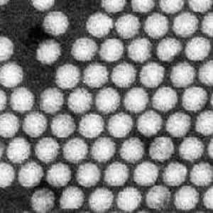 Polio: Dari Misteri Kelumpuhan hingga Terbukti sebagai Penyakit Menular