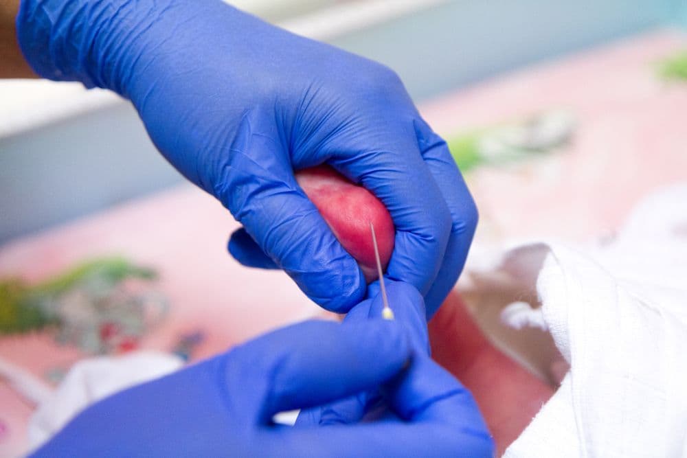 Kebijakan Skrining Hipotiroid Kongenital di Indonesia