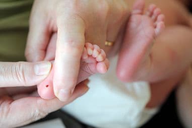 Phenylketonuria: Diagnosis dan Tatalaksana