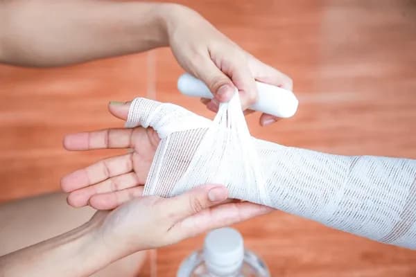 Luka Bakar: Koreksi Cairan dan Prinsip Tatalaksana Awal Lainnya