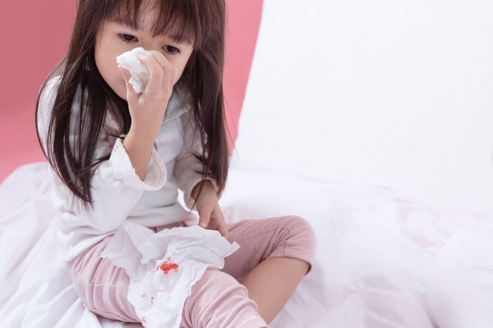 Epistaksis pada Anak: Etiologi, Pertolongan Pertama, dan Tata Laksana