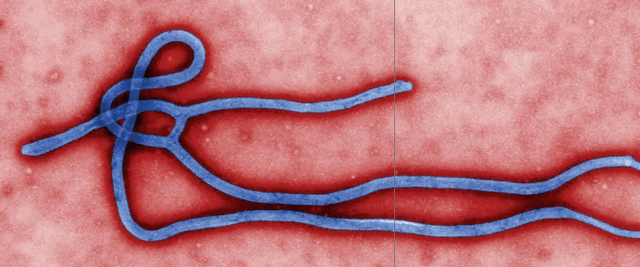 Ebola Kembali Mengancam: 80 Meninggal Karena Strain Baru di Republik Demokratik Kongo