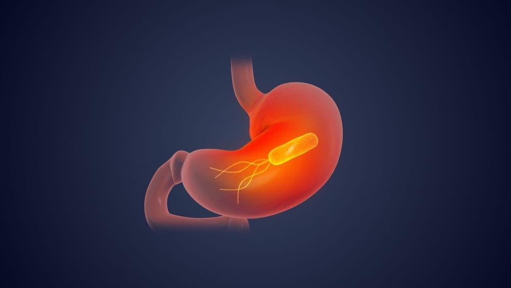Helicobacter pylori pada Anak: Menifestasi Klinis, Diagnosis, dan Tatalaksana