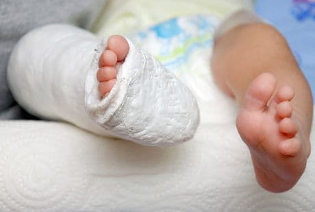 Greenstick Fractures: Pendekatan dan Prognosis