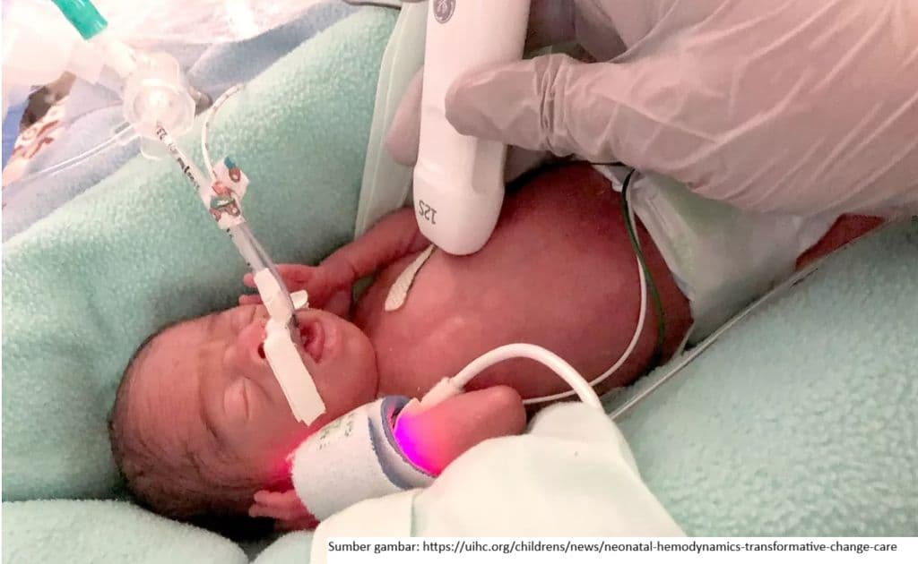 Patent Ductus Arteriosus: Tinjauan Singkat bagi Dokter Anak