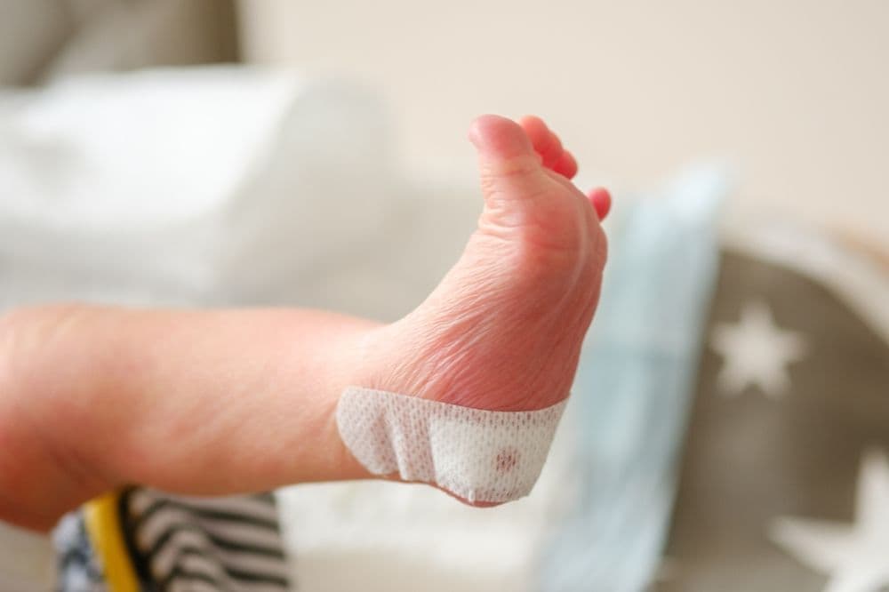 WHO Tekankan Pentingnya Perluasan Skrining Bayi Baru Lahir