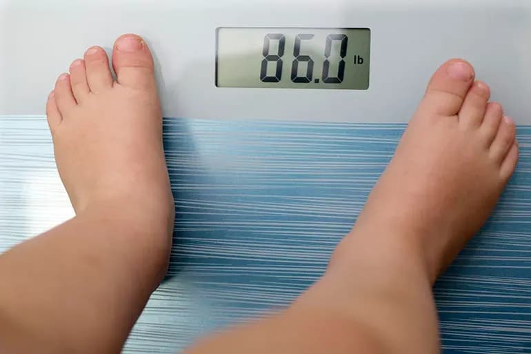 Panduan Evaluasi dan Tatalaksana Obesitas pada Anak dan Remaja AAP 2023