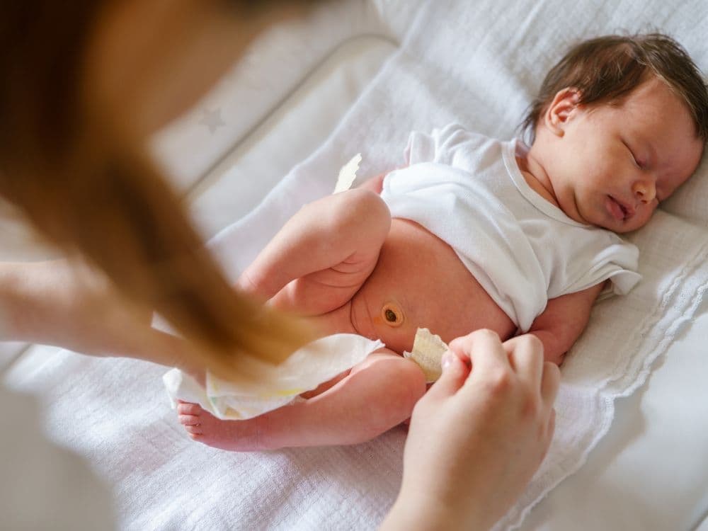 Pengelolaan Diaper Rash