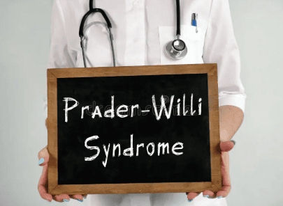Prader-Willi Syndrome: Diagnosis, Tata Laksana, dan Prognosis