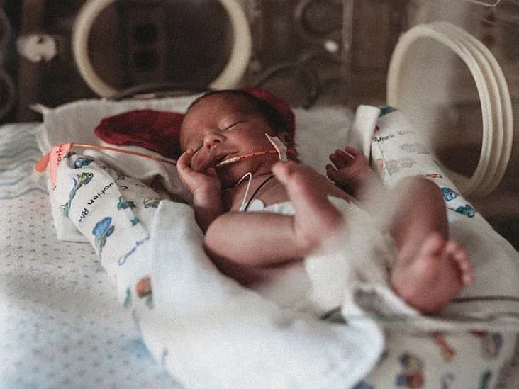 Hubungan Persistent Pulmonary Hypertension of the Newborn dengan Sindrom Aspirasi Mekonium