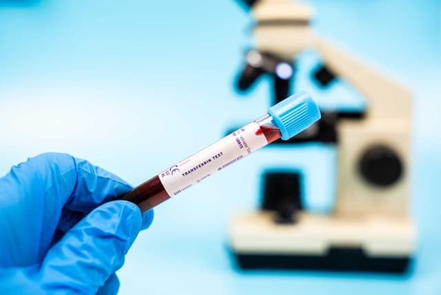 Guideline Defisiensi Besi Telah Diperbarui
