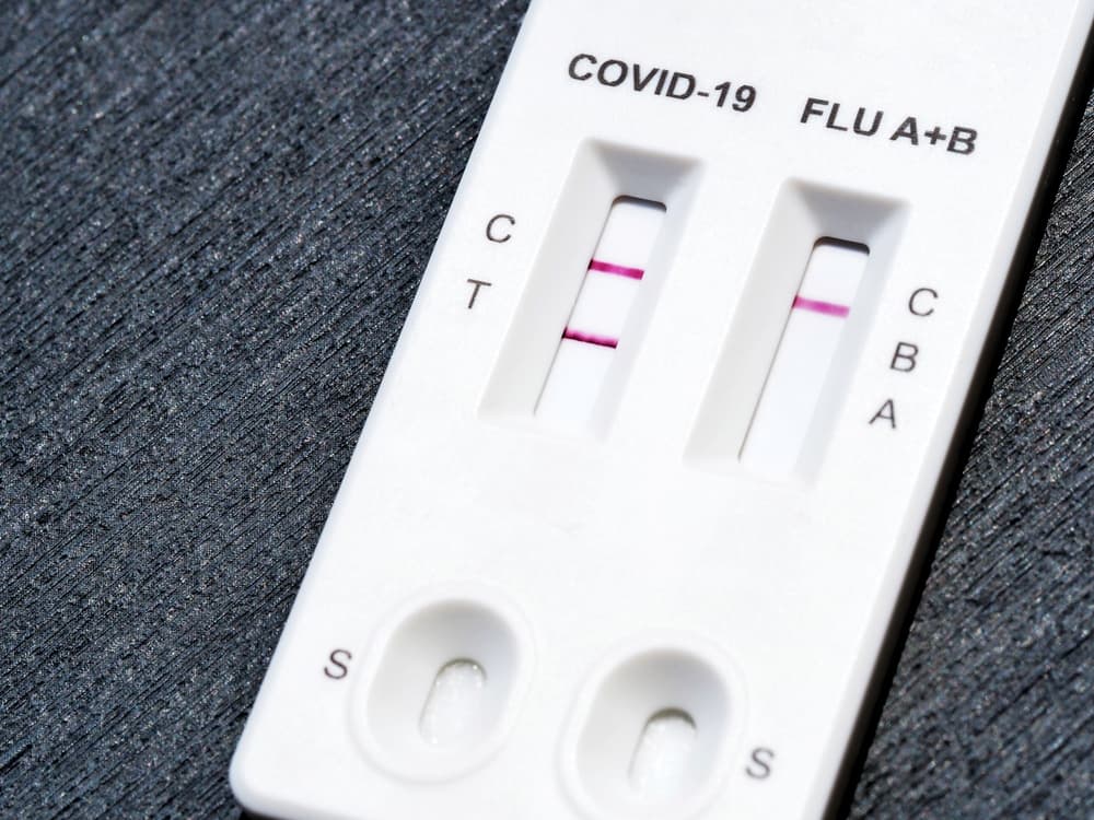 Apakah Rapid Test Influenza Perlu Dilakukan pada Setiap Kasus Influenza-like Ilness?